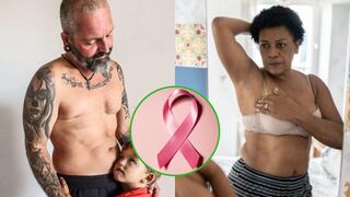Cáncer de mama en Perú afecta a varones y mujeres: ¿Quiénes son vulnerables a padecerlo?