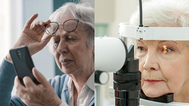 Degeneración macular: Todo sobre la principal causa de ceguera en adultos mayores