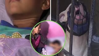 Niño de 5 años es atacado salvajemente por perro pitbull en SJM (VIDEO)