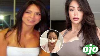 Sheyla Rojas: ¿Cuántas cirugías plásticas tiene la modelo?