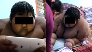 Niño 'más obeso del mundo' baja de peso y luce cambio radical (FOTO)