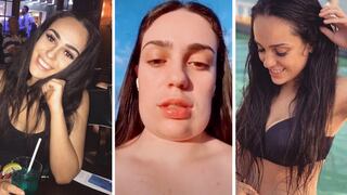 Mujer se deforma el rostro al hacerse tratamiento para eliminar papada | VIDEO