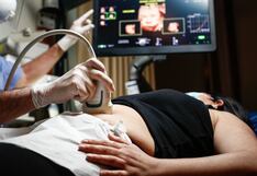 ¿Cuántas ecografías son necesarias durante el embarazo?