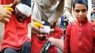 ​Youtube: Niño finge tener la cara quemada para pedir limosna pero es descubierto