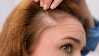 Comer para vivir: Por qué se cae más el cabello en la menopausia