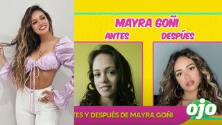 Mayra Goñi: analizan el ‘antes y después’ de la actriz con reveladoras fotos │VIDEO