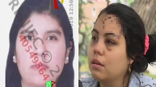 Peruana ataca brutalmente a su examiga venezolana y la deja desfigurada│VIDEO