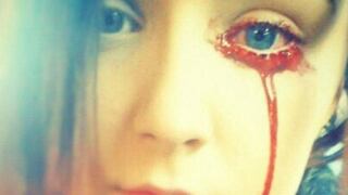 Adolescente de 17 años llora sangre y nadie da con su mal [VIDEO] 