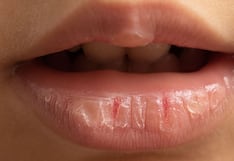 Comer para vivir: Por qué se te seca la boca sin razón aparente