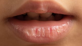Comer para vivir: Por qué se te seca la boca sin razón aparente