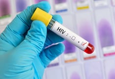 Minsa: Más 110 mil peruanos viven con VIH, y el 60% de los casos son de Lima y Callao