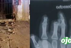 Huánuco: Sujeto acusado de extorsión perdió varios dedos de sus manos tras intentar detonar explosivo