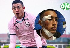 Fabrizio Roca narra brutal agresión de supuestos hinchas: “Cogí un taxi para escapar” (VIDEO)