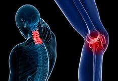 ¿Qué es la osteoartritis? Conozca más sobre esta enfermedad reumática crónica