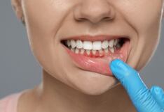 ¿Sabías que vapear también puede afectar tu salud bucal?