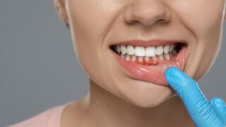 ¿Sabías que vapear también puede afectar tu salud bucal?