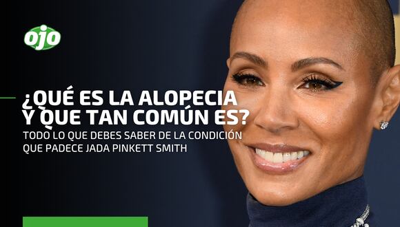 Alopecia: todo sobre la condición que padece la esposa de Will Smith