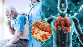 Día mundial de la tuberculosis: ¿Cuáles son los signos y síntomas de esta enfermedad?