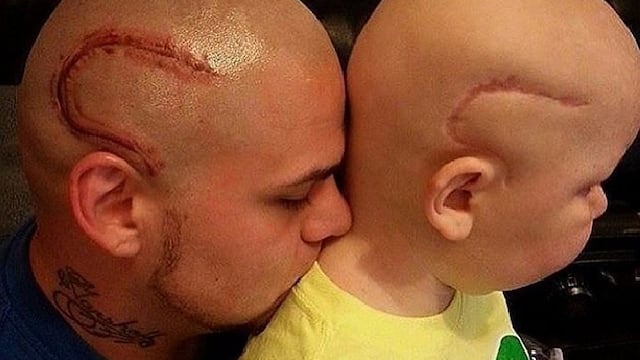 ¡Papá se tatúa la misma cicatriz que tiene su hijo con cáncer! [FOTO]