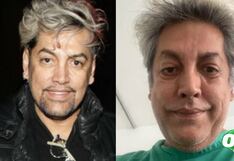 Koky Belaunde fue internado de emergencia y pasó por una delicada cirugía: ¿Qué le sucedió?