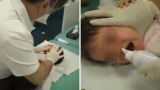 El "inusual" método que utilizan médicos franceses para eliminar la flema en niños (VIDEO)