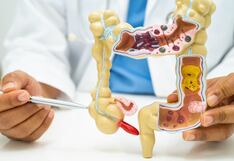 Cáncer de colon: ¿por qué la diarrea o el estreñimiento no deben ignorarse?
