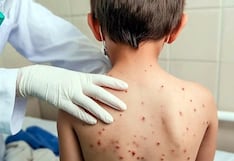 Casos de sarampión y tos ferina en alza