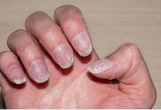 Comer para vivir: Por qué se debilitan las uñas en la mujer