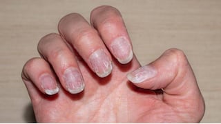 Comer para vivir: Por qué se debilitan las uñas en la mujer