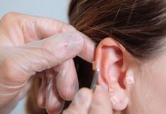 La columna de Pérez Albela: auriculoterapia, la terapia en la oreja