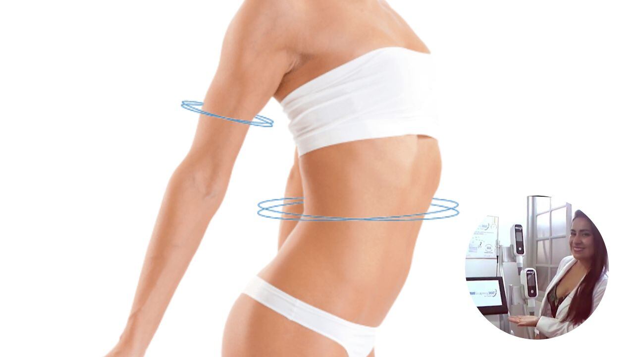 Criosculpting® 360. Es un sistema americano de reducción y reafirmación de grasa que elimina el tejido adiposo de forma controlada por medio del frío.