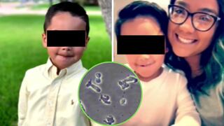 Niño de seis años muere a causa de una ameba “come cerebros” tras jugar en una fuente de agua pública | VIDEO