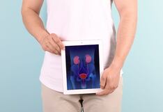 Cáncer de próstata: Descubre si estás en riesgo de padecer esta enfermedad