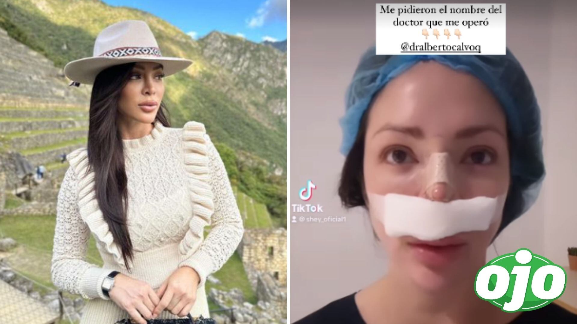 Sheyla Rojas se opera nuevamente. Foto: Composición Ojo