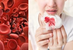 Hemofilia: La enfermedad silenciosa que afeta a 1 de 10 mil peruanos