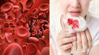 Hemofilia: La enfermedad silenciosa que afeta a 1 de 10 mil peruanos