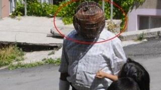 Hombre usa jaula en la cabeza para dejar de fumar [VIDEO]