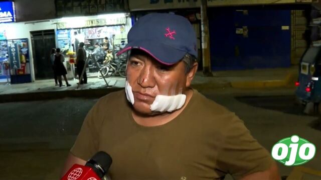 Delincuente ataca con un cuchillo a padre e hijo durante un asalto en Puente Piedra (VIDEO)