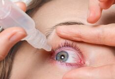 ¿Cómo afecta el fenómeno El Niño a tu salud visual?