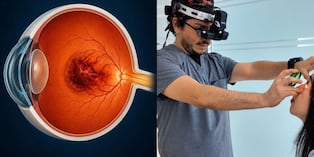 Avances innovadores contra la degeneración macular