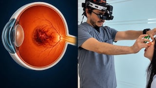 Avances innovadores contra la degeneración macular