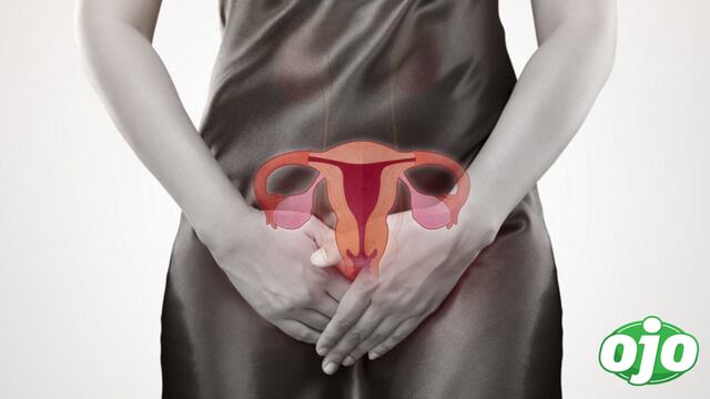 7 factores que incrementan el riesgo de desarrollar cáncer de cuello uterino