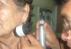 Lunares peligrosos: signos y síntomas del cáncer de piel tipo melanoma