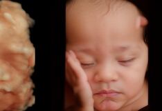 Con Inteligencia Artificial convierten ecografías de bebés en imágenes hiperrealistas