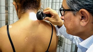 Hospital Almenara brindó tratamiento de fototerapia a más de 500 pacientes con vitiligo