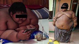 Niño "más obeso del mundo" baja 70 kilos y luce distinto (VIDEO)