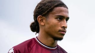 Dos futbolistas heridos en incendio en bar luchan por sus vidas