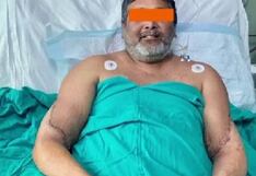 ¡Hazaña médica! Pintor que perdió ambos brazos recibió las extremidades de una mujer en un doble trasplante