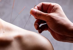 Comer para vivir: Acupuntura para el dolor, más que un placebo