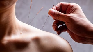 Comer para vivir: Acupuntura para el dolor, más que un placebo
